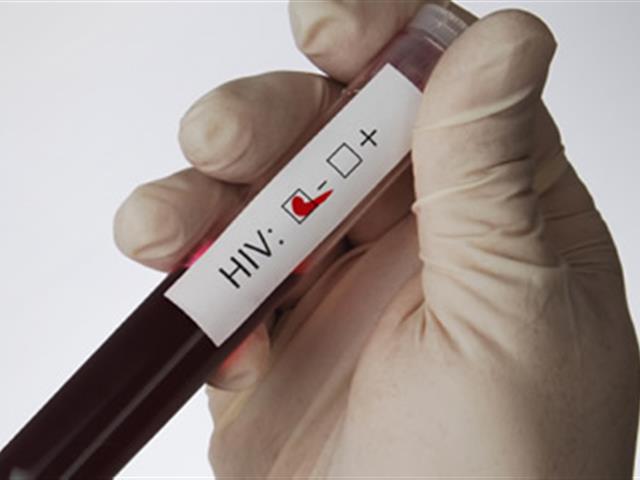 В Астрахани стартовало тестирование на ВИЧ для всех желающих