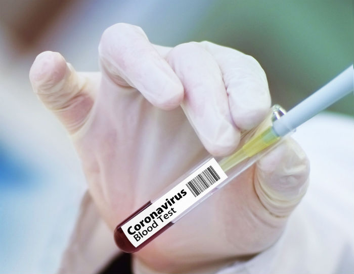 Число инфицированных коронавирусом в Астрахани превысило 100