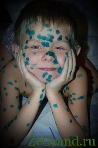 НЕ КОРИТЕ СЕБЯ! В Европейском регионе – эпидемия кори. 