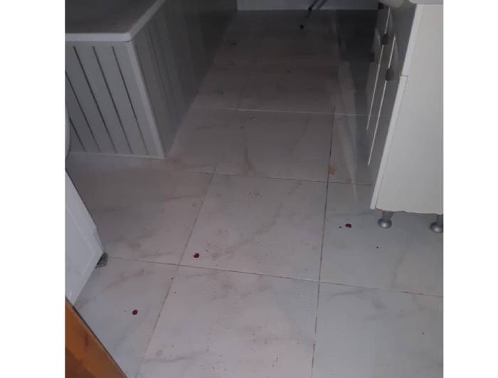 Астраханец исполосовал знакомого ножом из-за денег