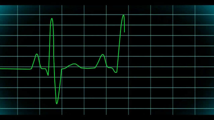Скончался еще один астраханец с коронавирусом, занимавшийся самолечением 