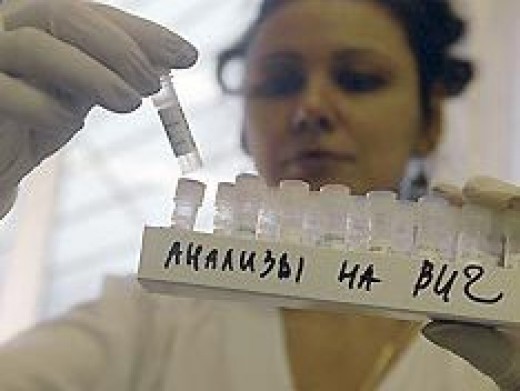 В Астрахани зарегистрирован крупный очаг ВИЧ-инфекции