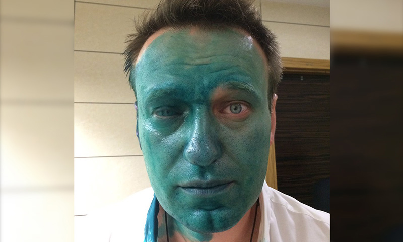 Из-за вчерашнего нападения Навальный перенес поездку в Астрахань