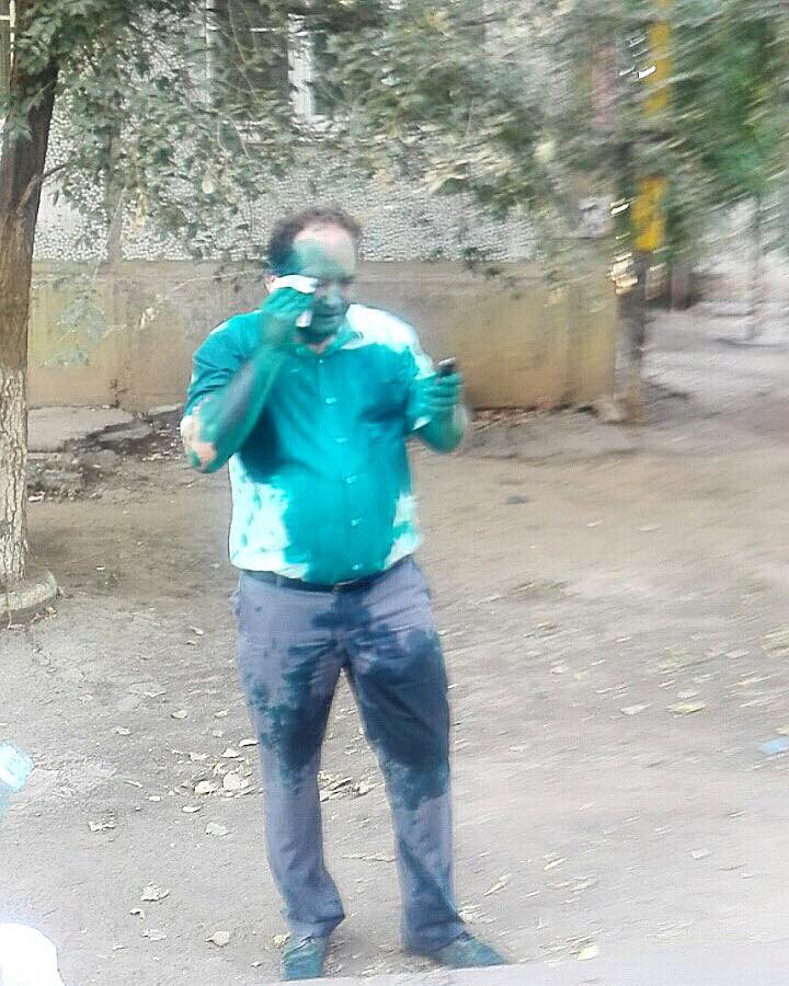 Предвыборная борьба стоила Александру Тукаеву зрения