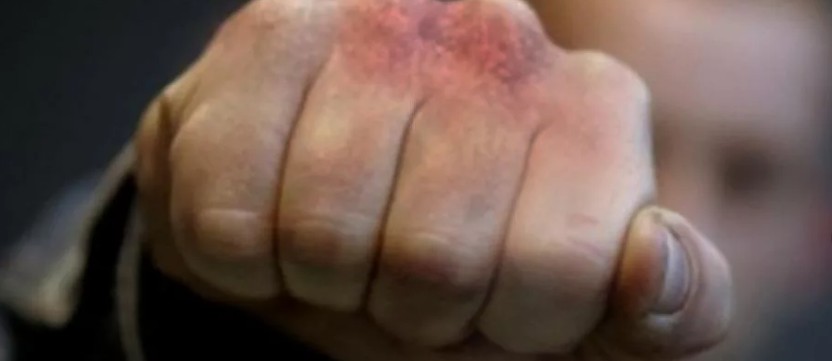 Астраханец сломал нос таксисту, не пожелавшему отвезли его домой после свадебного банкета