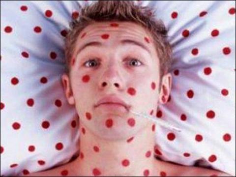 В Астраханской области продолжают фиксировать случаи кори