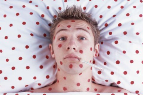 В Астрахани зарегистрировано 44 случая кори