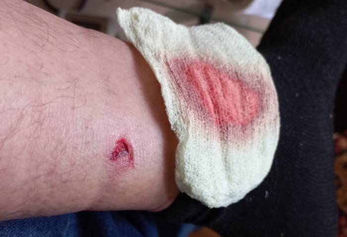 Еще на одного астраханца, который шел на работу, напали собаки