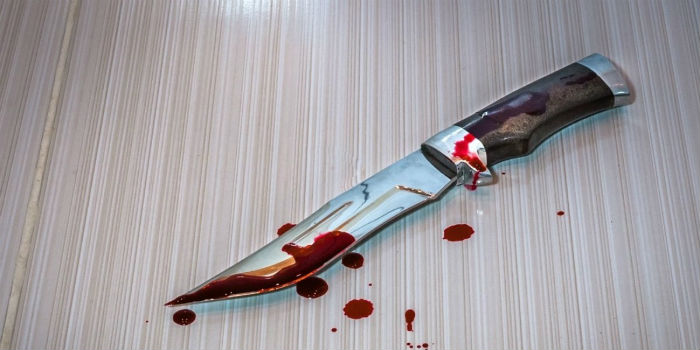 Астраханец выжил, будучи исполосованным ножом