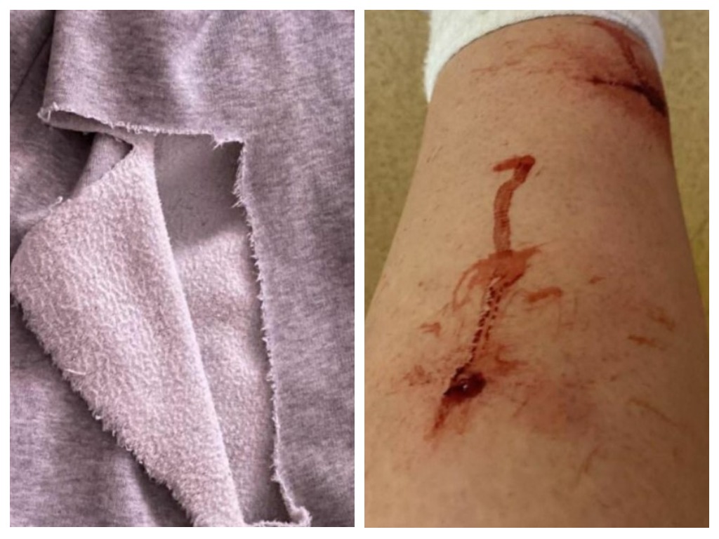 Возле астраханской гимназии более семи собак набросились на выпускницу и покусали ее