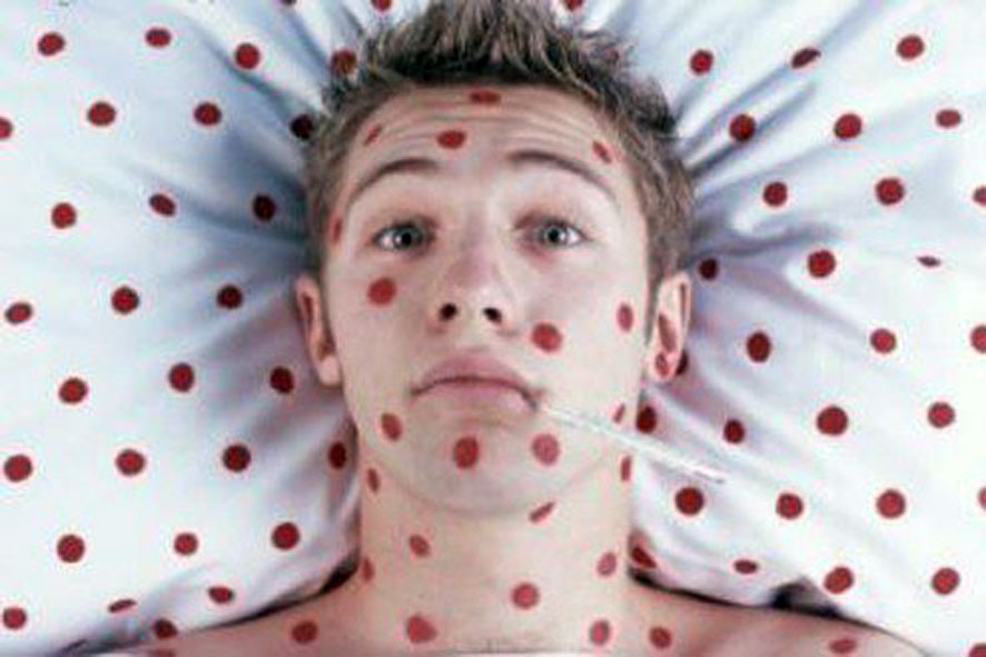  В астраханских школах и детских садах участились случаи кори