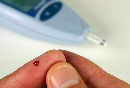 Астраханцы могут бесплатно сдать анализ крови на сахар