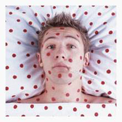 В Астраханской области зарегистрированы новые очаги кори