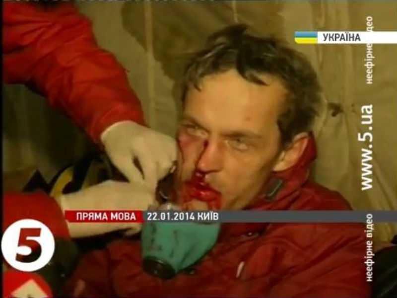 Активист из Астрахани ранен в столкновениях у Майдана