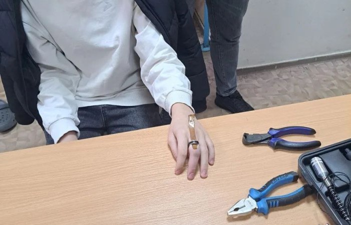 В Астрахани спасатели освободили подростка от кольца, застрявшего на пальце