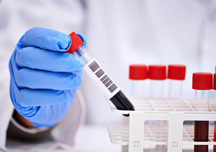 Коронавирус оказался беспощаден к астраханцам: почти 300 человек заразились за сутки