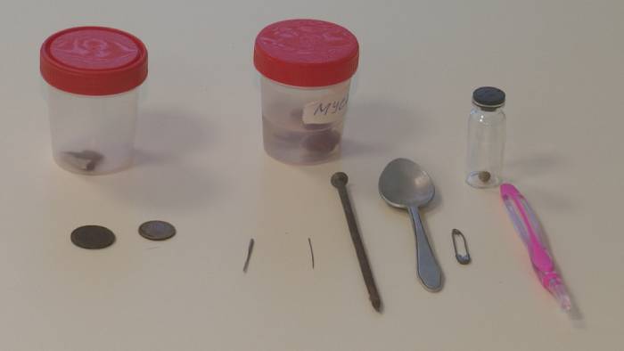 Зубные щётки, ложки и ржавые гвозди: врачи собрали коллекцию предметов, которые проглотили астраханцы