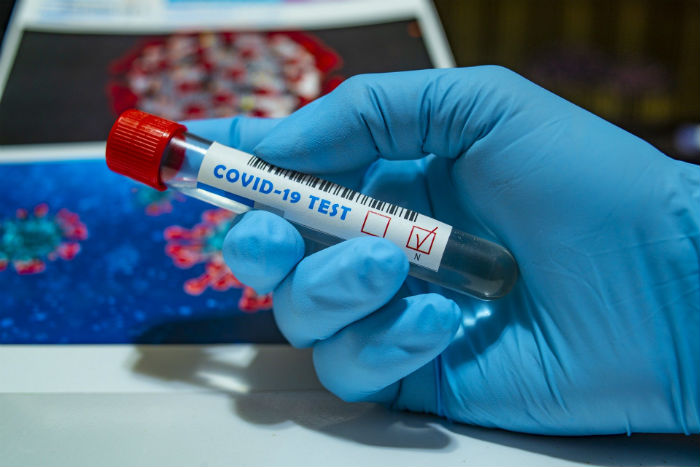 В Астрахани подтверждено еще 77 случаев коронавируса