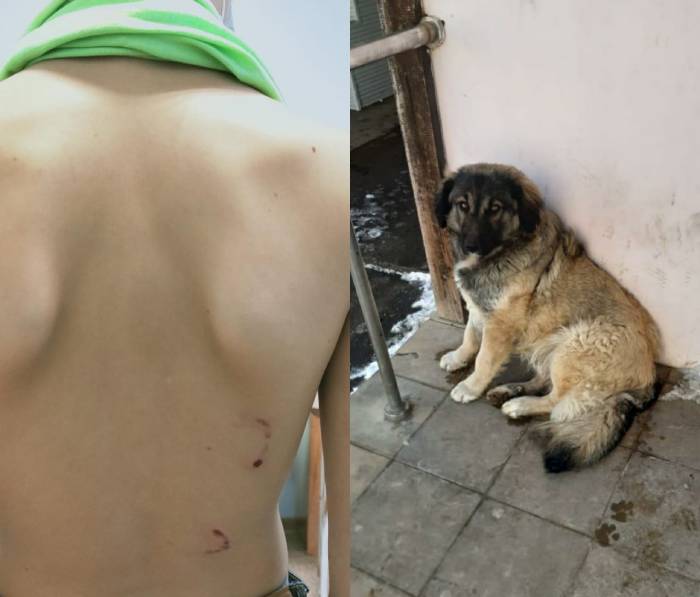 На улице в Астрахани дворовая собака напала на компанию детей, одного ребенка искусала до крови