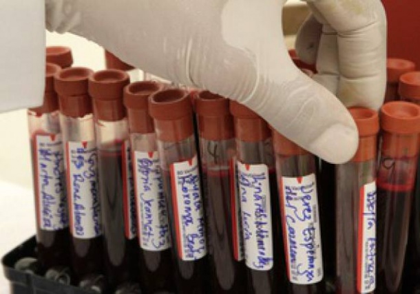 Еще 12 астраханцев заболели корью