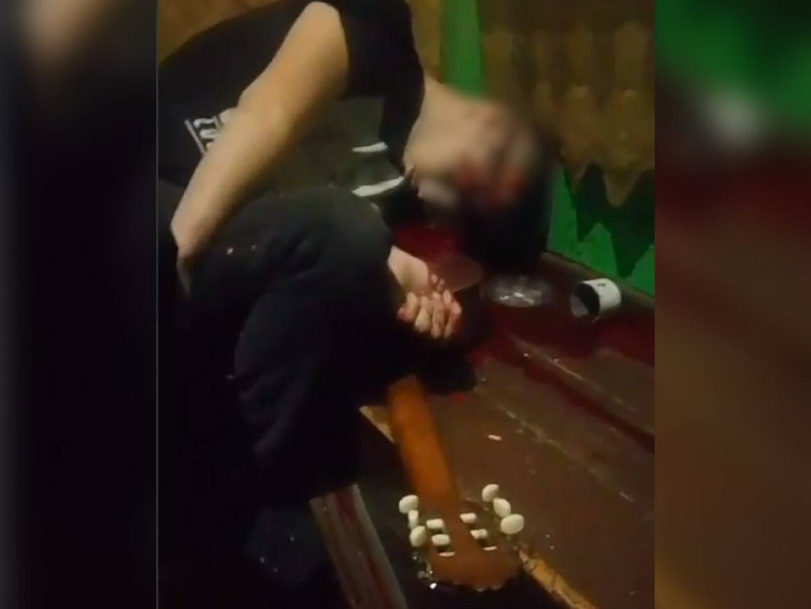 Пьяный астраханец выстрелил из ружья в голову 19-летнему парню