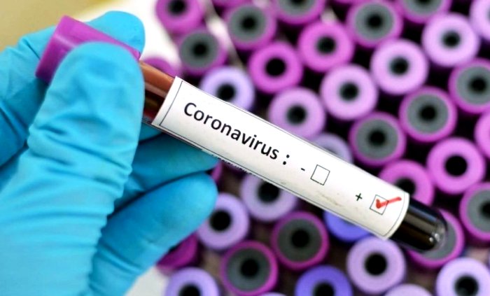 За сутки в Астраханской области заразился коронавирусом 41 человек