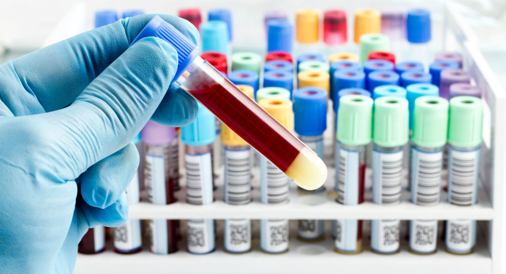 Опыт Астраханской области по выявлению онкозаболеваний будет распространен по всей стране