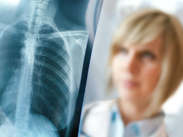 22 марта в сквере Филармонии начнет работу передвижной флюорограф