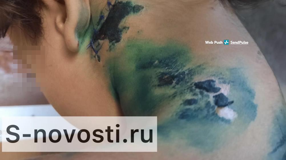 Трусовская прокуратура добивается компенсации для 4-летней астраханки, на которую напали собаки