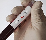 В Астрахани стартовало тестирование на ВИЧ для всех желающих