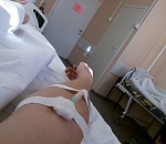 В Астрахани девочка, упавшая с крыши из-за селфи, вышла из комы