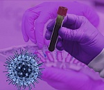 В Астрахани еще один случай заболевания коронавирусом