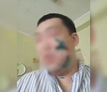 В астраханском кафе посетителю порезали лицо во время потасовки, видео