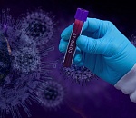 Коэффициент распространения коронавирусной инфекции в Астраханской области рванул вверх