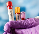 Печальная картина дня по коронавирусу в Астраханской области