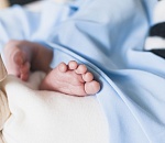 Астраханские хирурги спасли новорожденного от редкой патологии черепа
