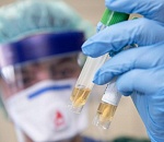 Россия готовится к возможному масштабному заражению коронавирусом