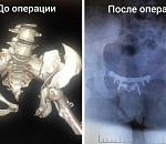 Это чудо: после страшного ДТП напротив "Ярмарки" астраханка снова может ходить