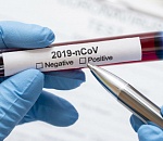 Кому из астраханцев не положен тест на коронавирус