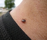 Клещи укусили астраханцев полторы тысячи раз