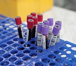 В Астрахани коронавирус продолжает наступление