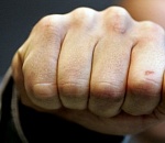 Пьяный астраханец жестоко избил пожилую семейную пару