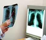 В Астраханской области стали чаще умирать от туберкулёза