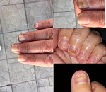 Астраханка записалась на маникюр и теперь ходит с уродливыми ногтями
