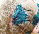 В Астрахани недалеко от места трагедии, где насмерть загрызли мужчину, семилетний ребенок подвергся жестокому нападению собаки 