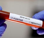 Известны первые результаты тестов на коронавирус у жильцов астраханского общежития