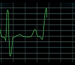 Скончался еще один астраханец с коронавирусом, занимавшийся самолечением 