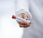 В Астраханской области за минувшие сутки коронавирус выявлен еще у 37 человек