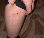 В Астрахани бродячие собаки напали и покусали школьника