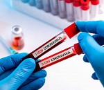 Ещё двое астраханцев скончались от коронавируса